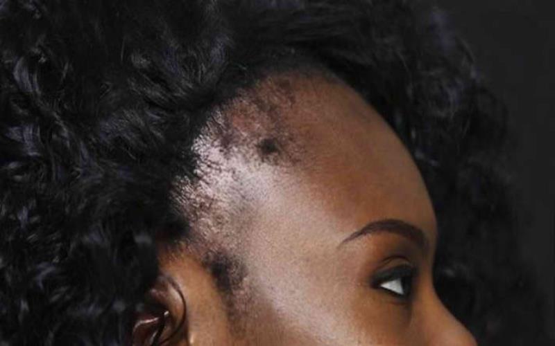 A Comprehensive Guide to Understanding Hair Fibers